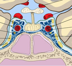 下垂体腫瘍に対するガンマナイフ治療